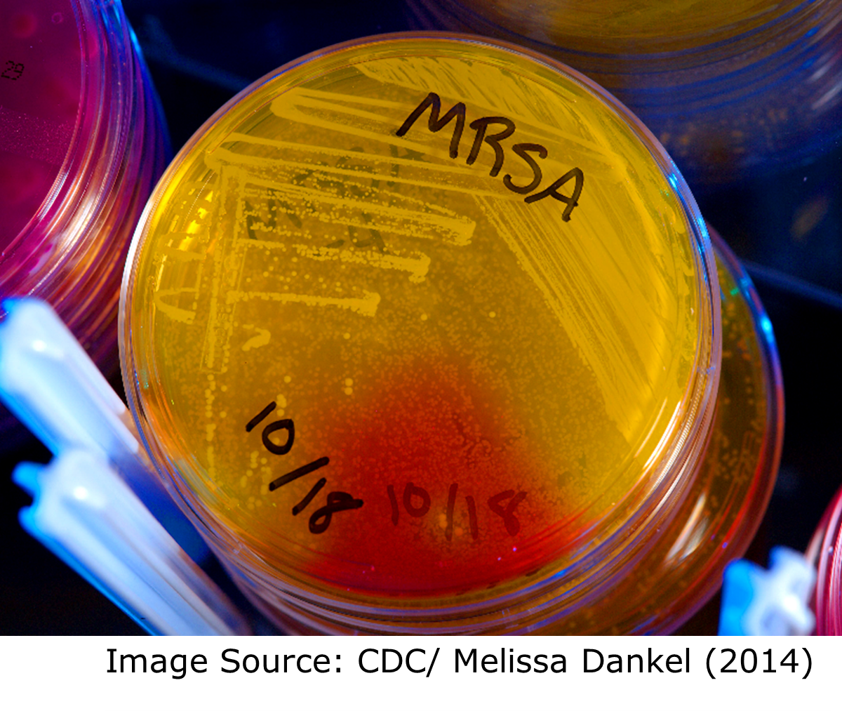 "A close up of an upturned petri dish with yellow and red colored agar. "