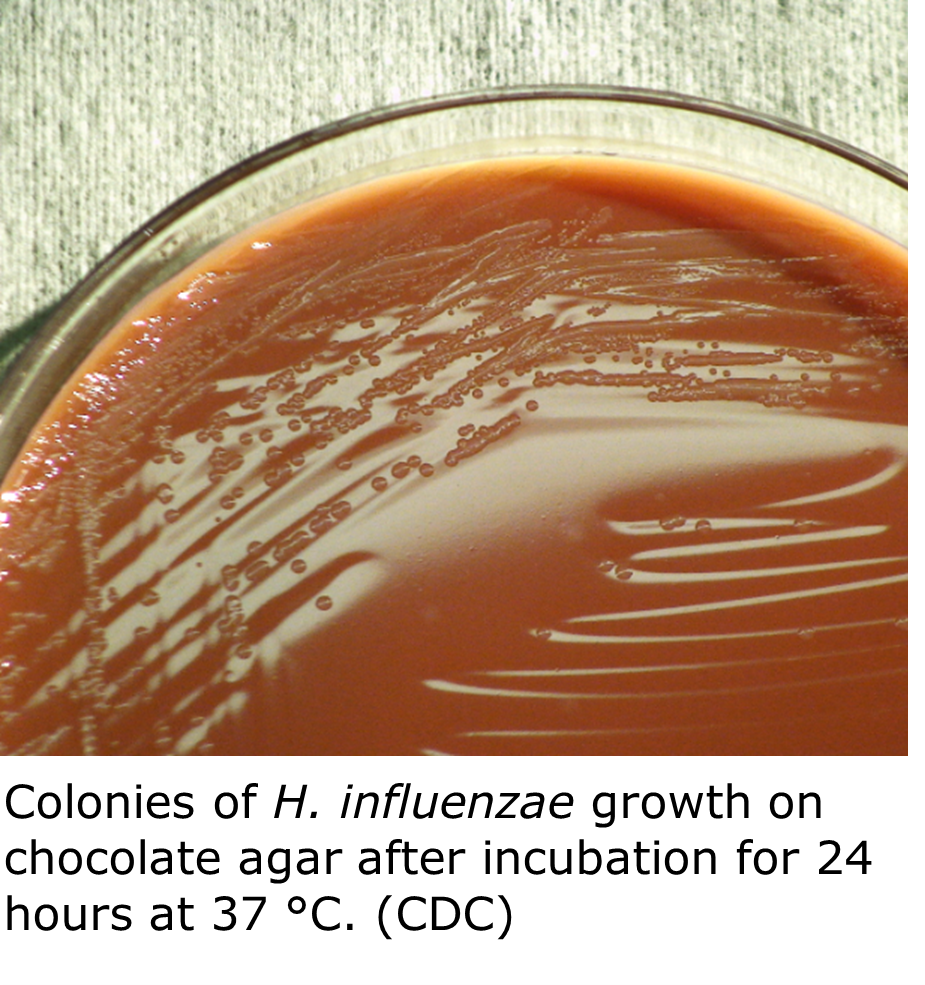 "Small colonies and confluent growth of H. influenzae bacteria on a brown solid chocolate agar surface in an Petri dish."