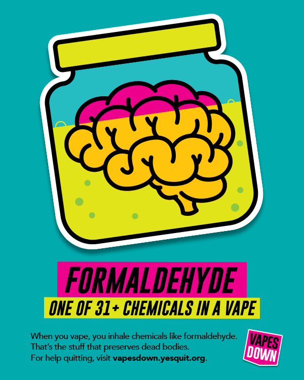 poster of a brain in a jar of chemicals