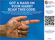 Syphilis Awareness Poster "Got a rash on your hand?"