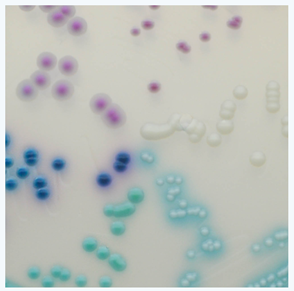 "Differentiation of Candida species on CHROMagarTM Candida Chromogenic agar. C. auris colonies are light blue with a blue halo. Image Source: CHROMagarTM"