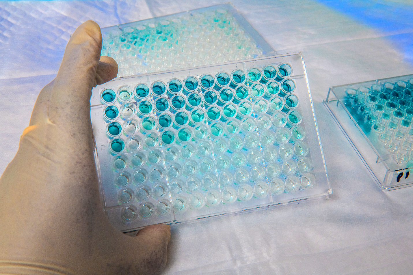 "A gloved hand holds a 96-microwell plate containing patient serum samples that are being tested for the presence of SARS-CoV-2 antibodies in a CDC serologic test."