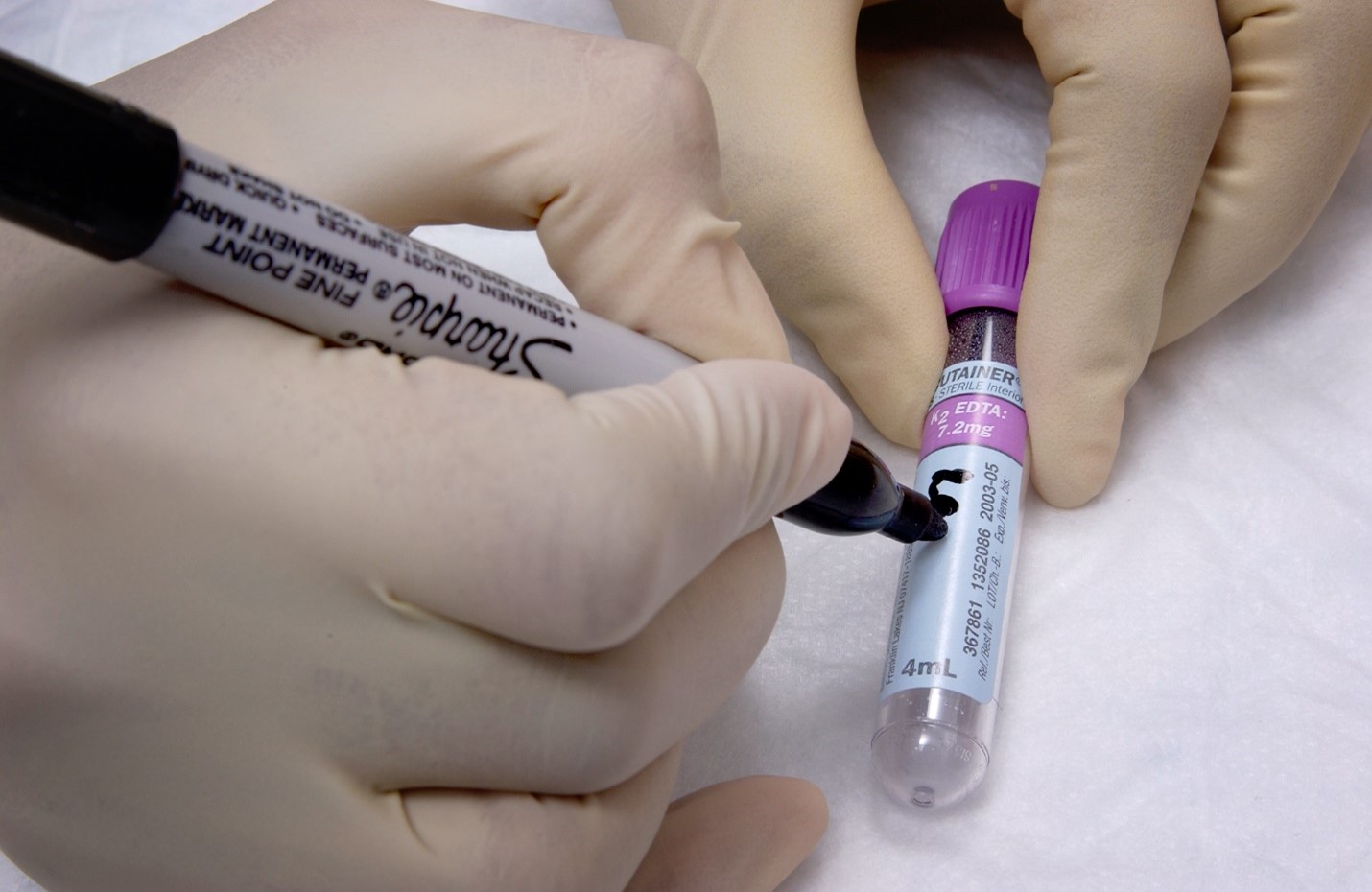 "A laboratory tech with gloved hands holds a purple top vacutainer tube while they write on the container's label with a fine-tipped permanent marker. "