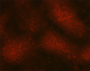 "A micrograph showing a dull reddish-brown area, with a distinct lack of green fluorescence, which would indicate the presence of rabies virus particles. "