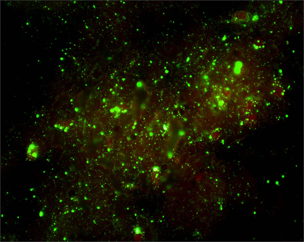 "Micrograph showing rabies virus particles fluorescing in green when exposed to fluorescein-labeled antibody specific to rabies virus."