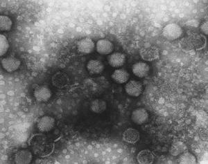 Adenovirus image 1