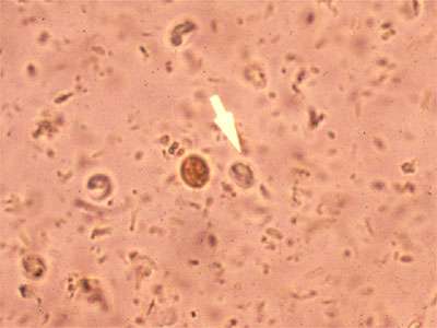 Cryptosporidium