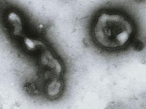 Influenza image 1