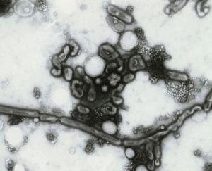 Influenza image 2