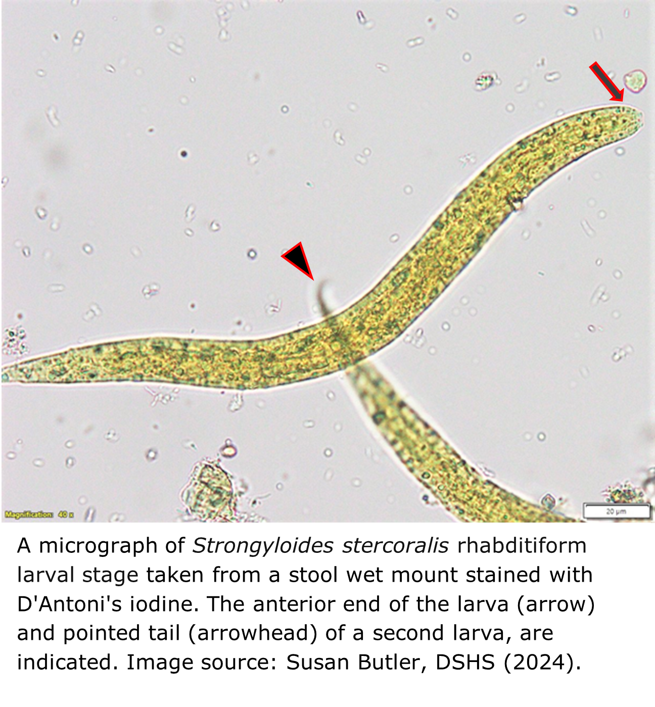 A micrograph image of a greenish-yellow worm
