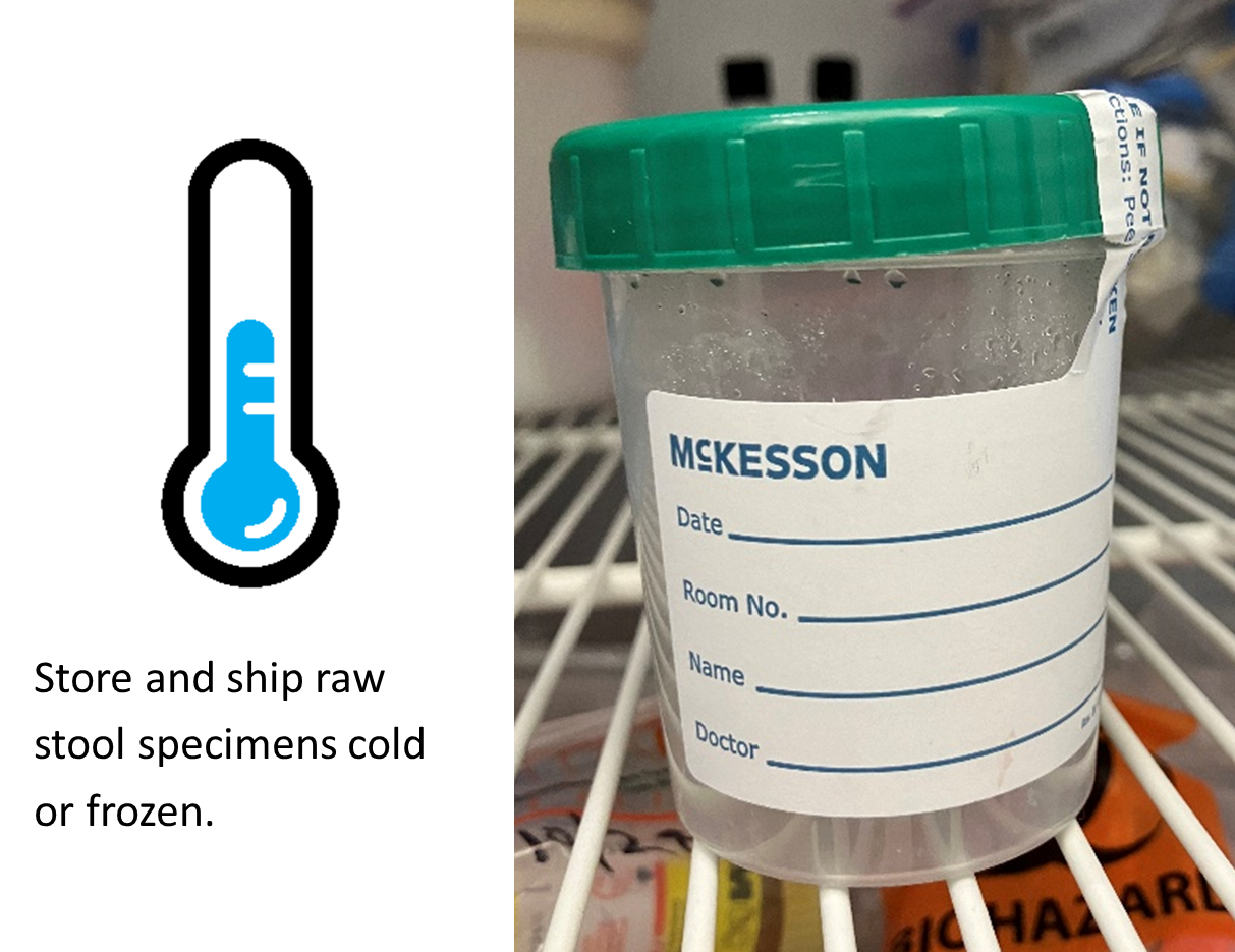 A photo of a raw stool specimen container with a green lid and white label. 