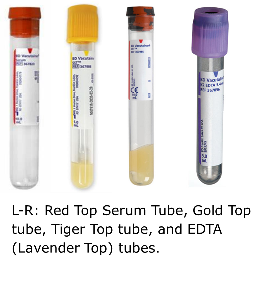 Four specimen collection tubes, from left to right, a red-top tube, a Gold Top tube, Tiger Top tube, and EDTA (Lavender Top) tube. 