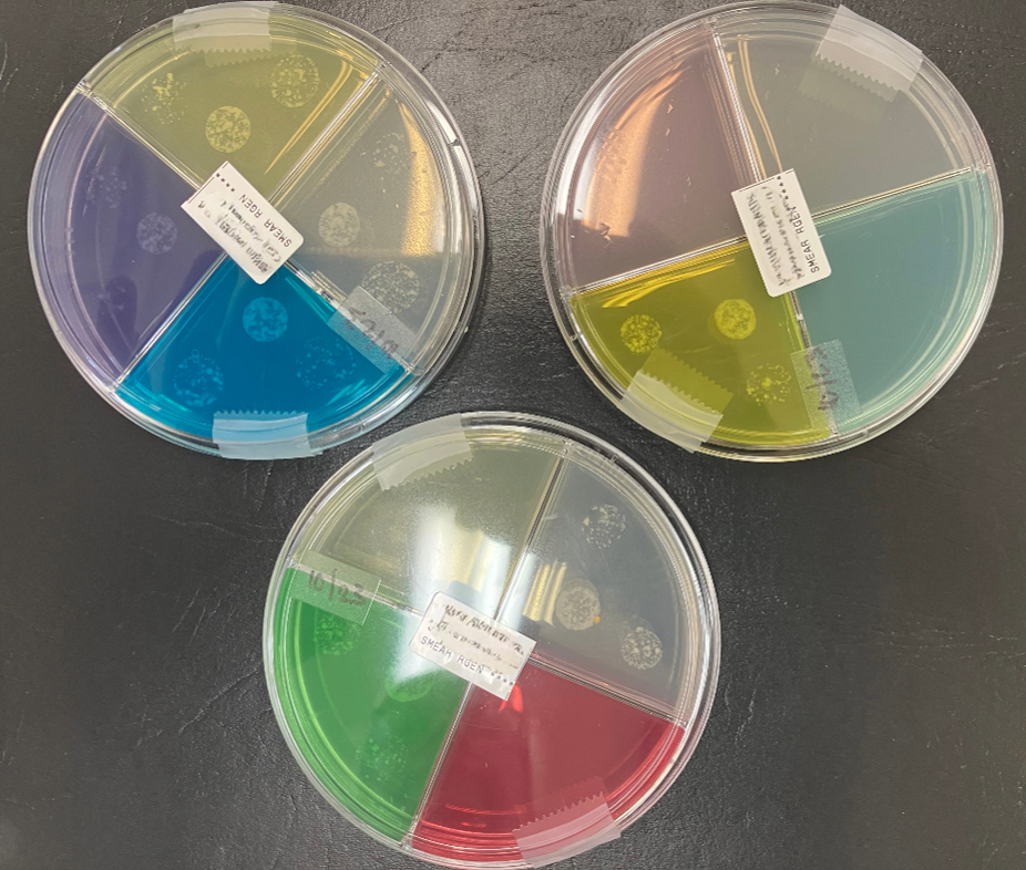 Quadrant plates with selective M. tuberculosis growth. Photo by DSHS, 2024