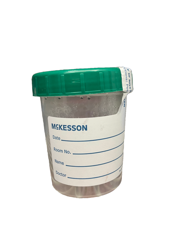 specimen container