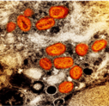 A micrograph of Positive Human Monkeypox Virus particles. The oval-shaped particles are false-colored orange on a beige-brown background.