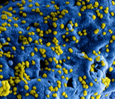 MERS CoV Specimens under microscope