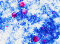 Group 49, Grouped object