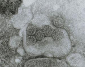 Papovavirus