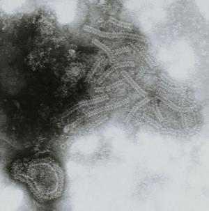 Paramyxovirus with Nucleocapsid helixes