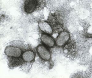 Pox virus