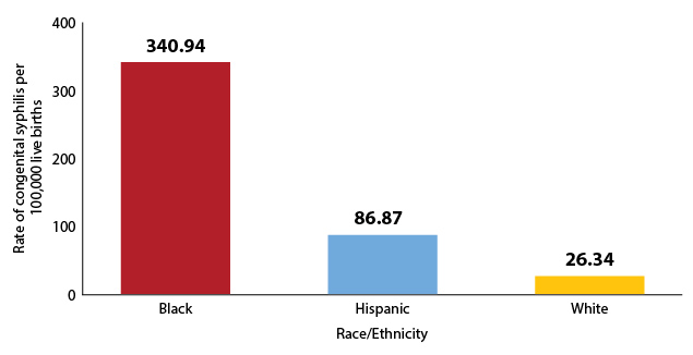 Figure 10: CS rates in infants by the race/ethnicity of the mother, Texas 2018. Black 340.94, Hispanic 86.87, White 26.34.