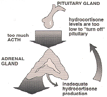 image of pituitary gland and adrenal gland indicating hydrocortisone levels are too low to turn off pituitary resulting in inadequate hydrocortisone production