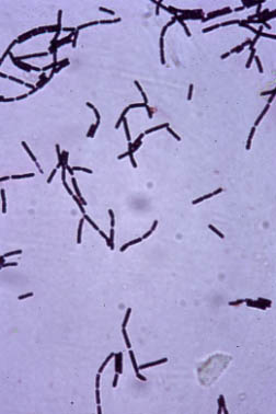 Anthrax Image