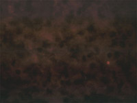 Picture of negative rabies specimen