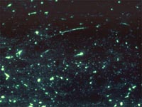 Rabies Positive The rabies virus fluoresces when exposed to fluorescein-labeled antibody specific to rabies virus. Picture