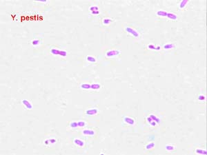 Yersinia pestis